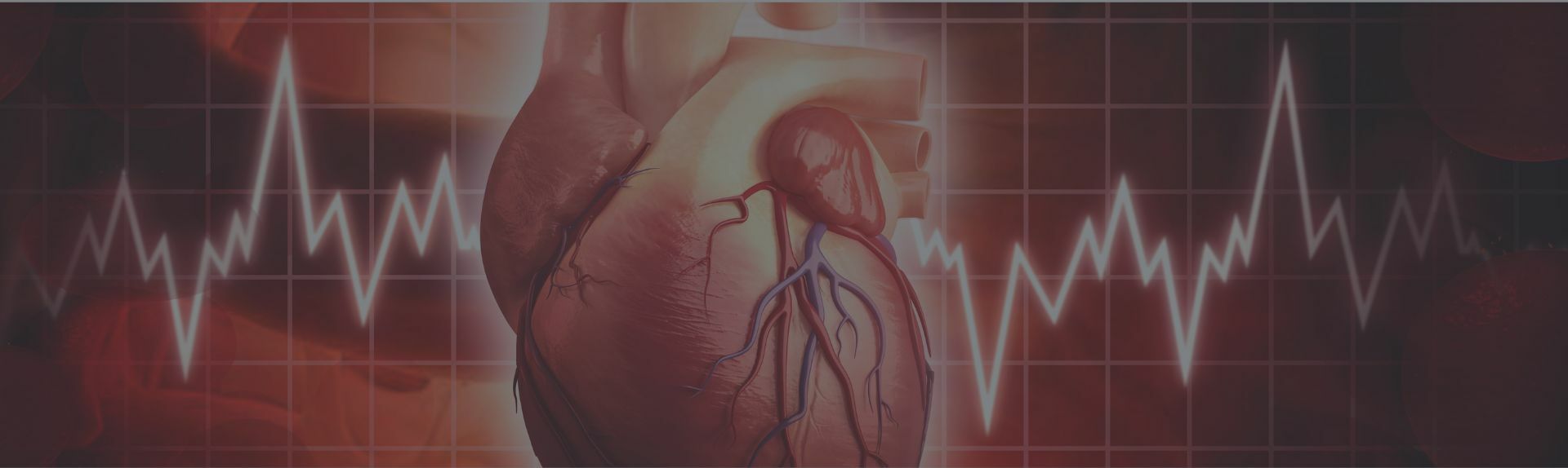 Corso Emergenze Cardiologiche e lettura ECG con casi clinici - 30 ECM